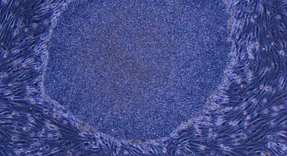 El Observador | Japón- Imagen de Aplicación de Células iPS de la Universidad de Kioto, parte del estudio que ganó el Nobel