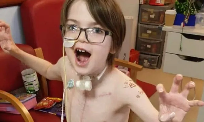 Kori, fotografiado aquí después de su segundo trasplante, es un fanático de la saga Piratas del Caribe