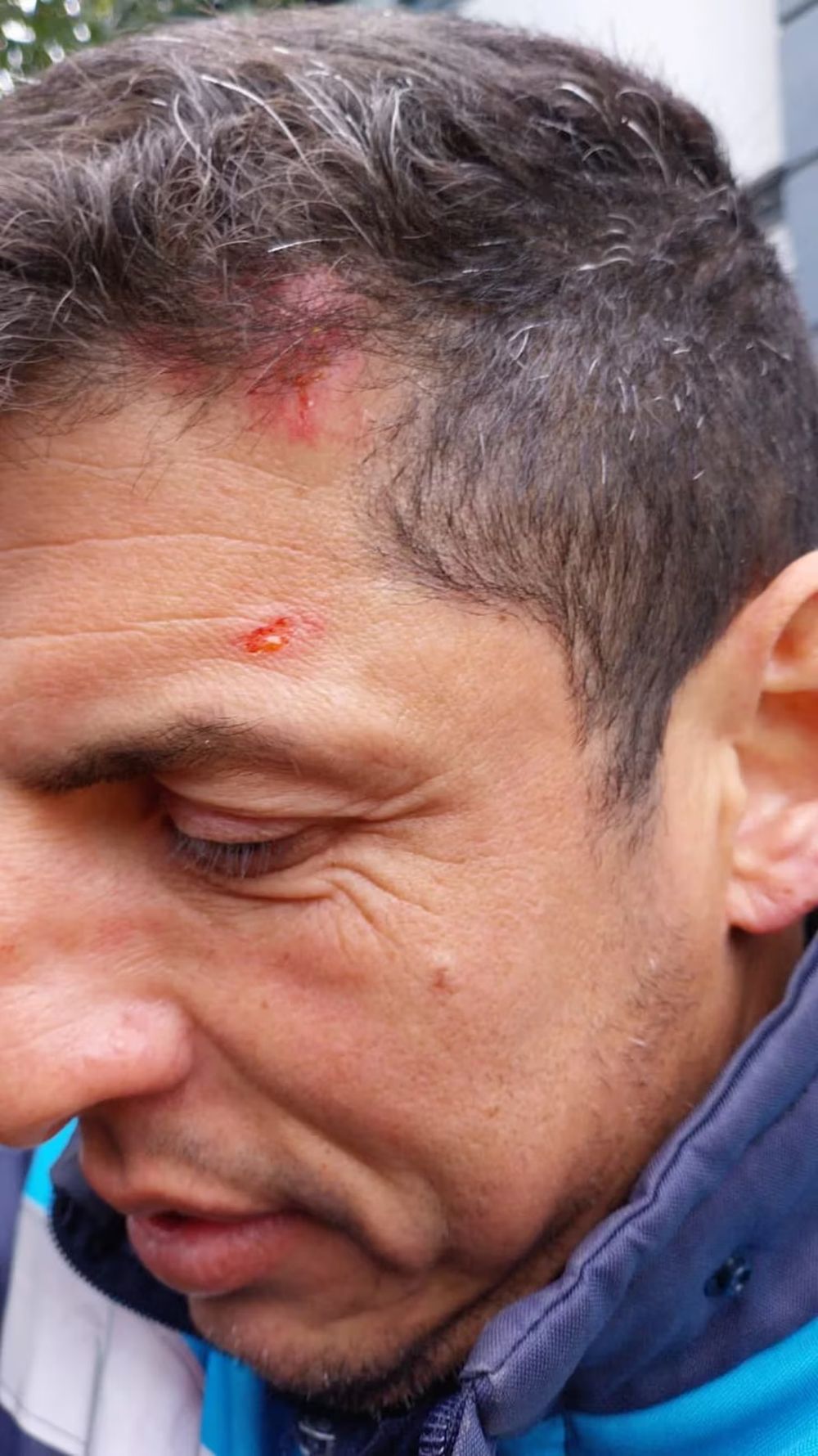 Matías Pallarini, el agente de tránsito herido, sufrió golpes en su cabeza.