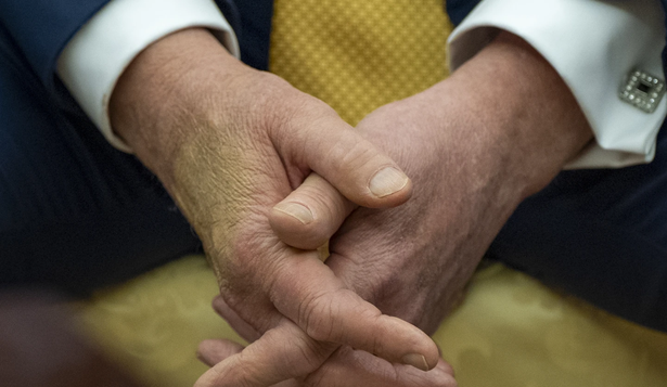 La salud de Donald Trump en la mira: por qué el presidente de EEUU tiene moretones en sus manos