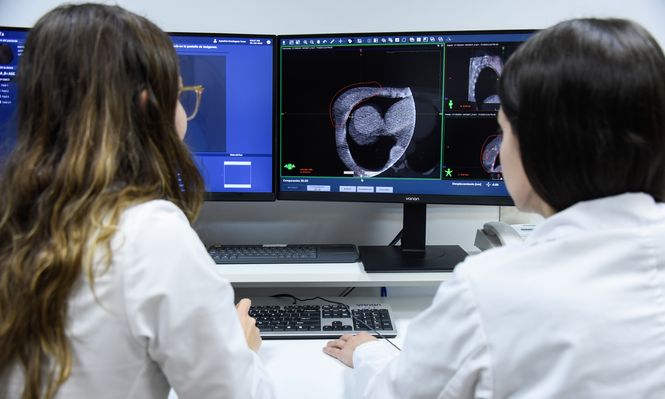 Nueva tecnología de radioterapia acorta francamente los tiempos de tratamiento