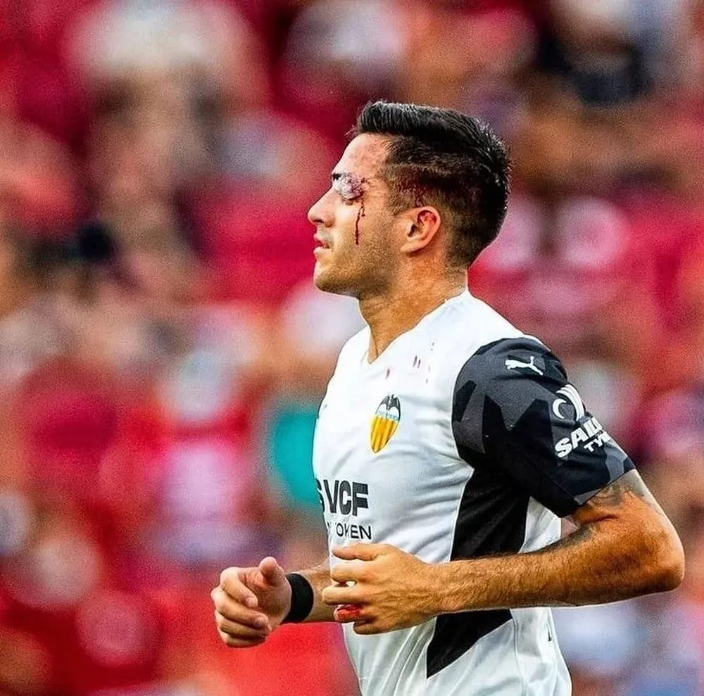 El corte que sufrió Maxi Gómez