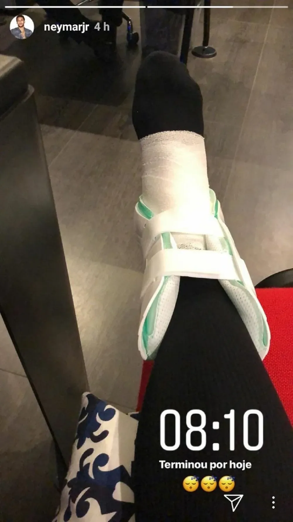 Neymar subió esta foto de su tobillo este lunes