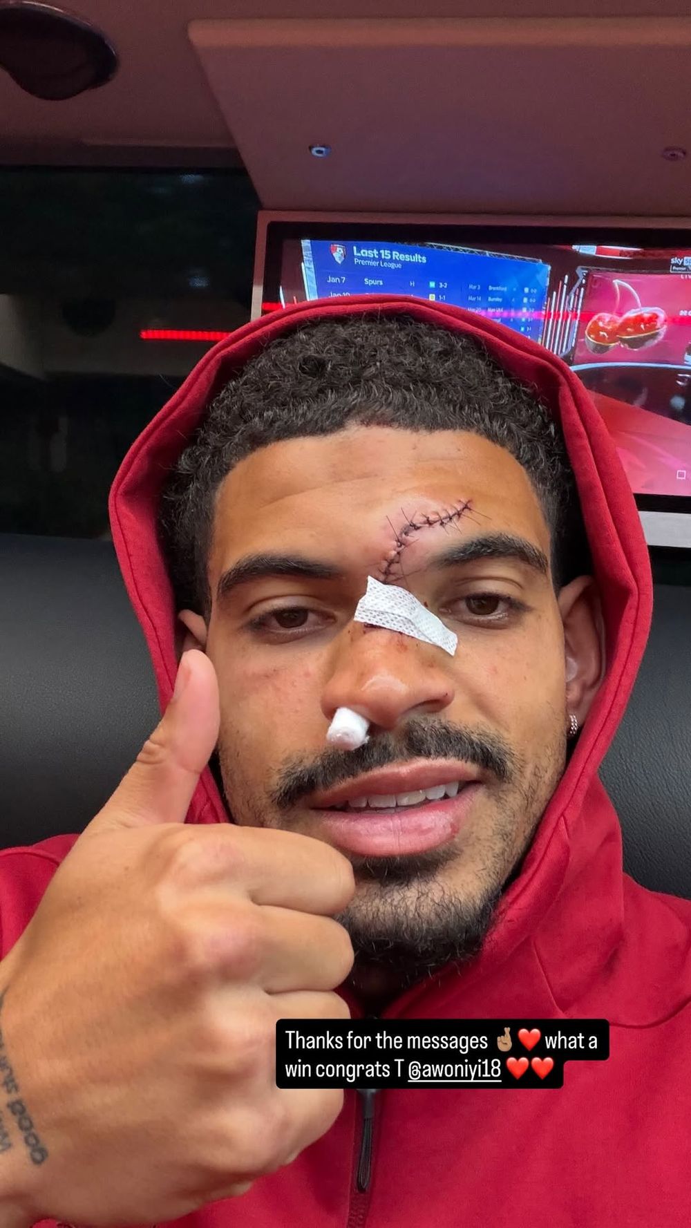 La impactante cicatriz que le quedó a Morgan Gibbs-White