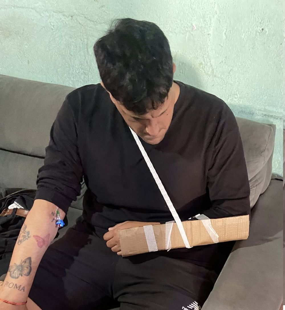 Fractura de un joven en San José