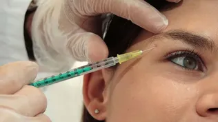 Crece el uso del bótox en Uruguay como alternativa a las cirugías