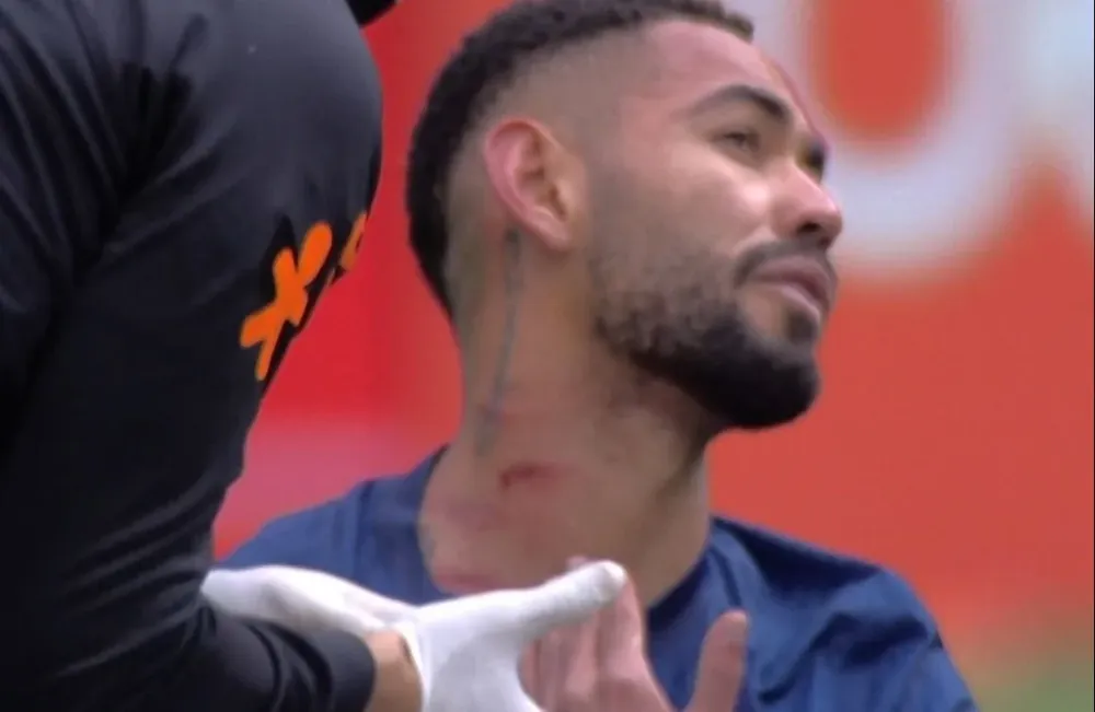 Matheus Cunha tras la patada de Domínguez