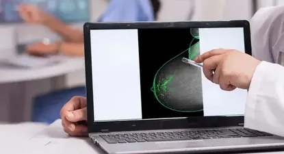 Investigación del cáncer de mama