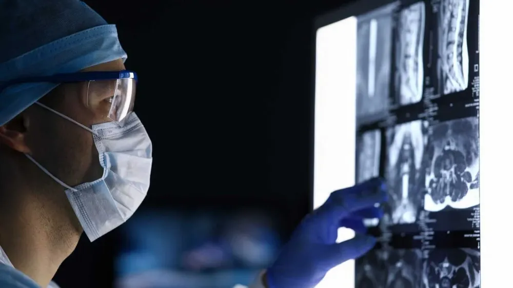 Las tasas de incidencia de aparición temprana se registraron en América del Norte, Australasia y Europa Occidental