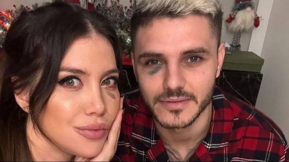 Icardi termina con un ojo morado y Galatasaray denuncia manipulación del VAR en clásico de Turquía