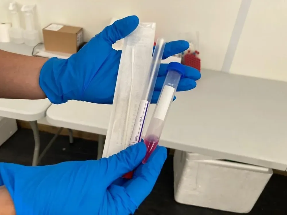 España limita el precio de las pruebas de autodiagnóstico covid