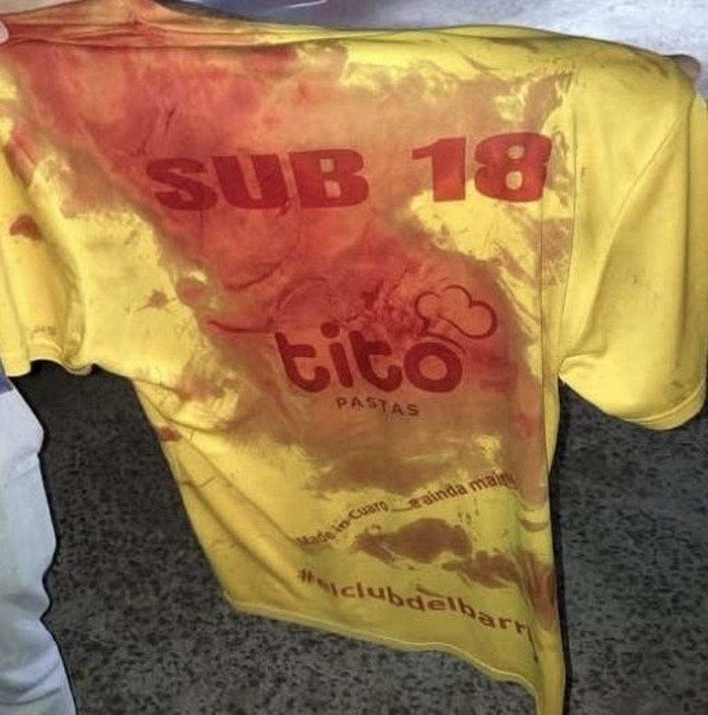 Adolescentes heridos tras episodio de violencia en Rivera