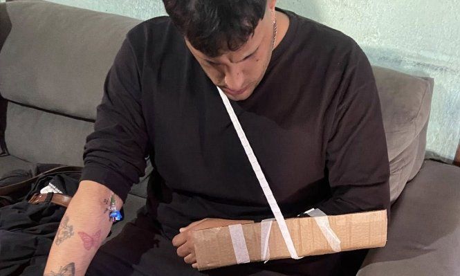 Fractura de un joven en San José