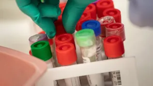 Cómo trabaja el consorcio que ganó el fondo ANII para 10.000 kits de diagnóstico