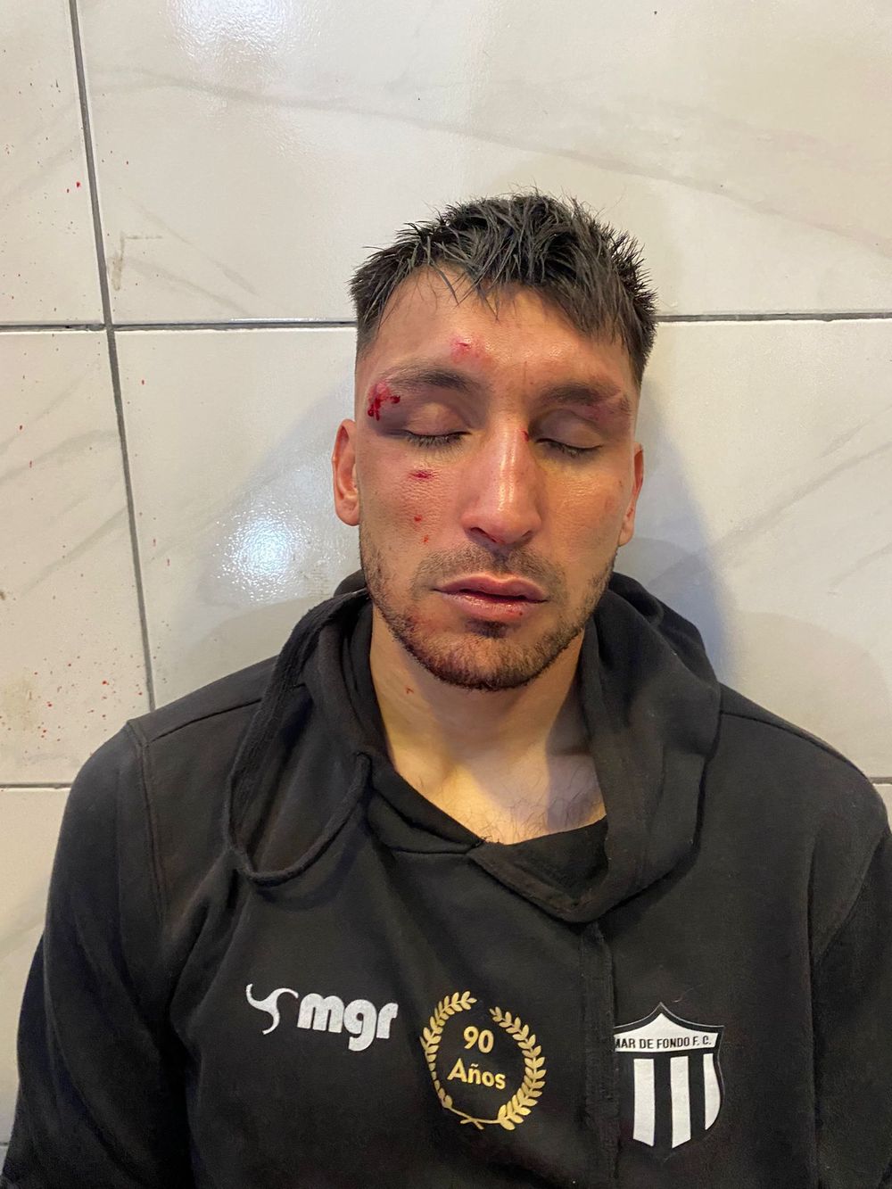 Así quedó Lucas Suárez