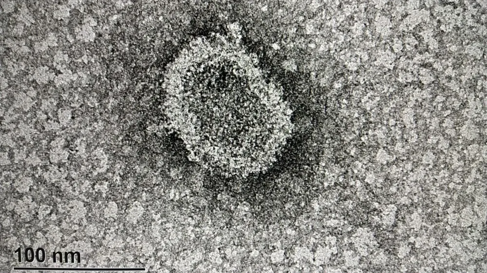 Investigadores uruguayos dieron a conocer las primeras imágenes del coronavirus, en Uruguay, el 15 de setiembre