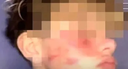 Italia multa a Tik Tok con 10 millones de euros por el reto de la cicatriz francesa.