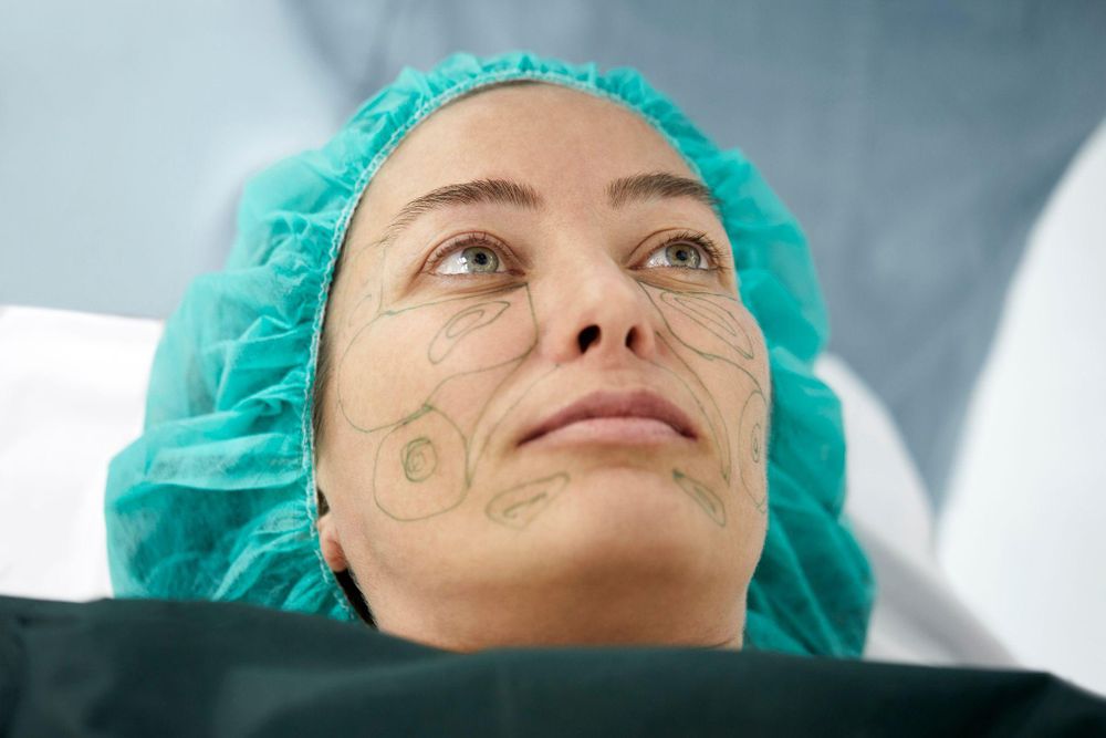 El estiramiento facial requiere hacer incisiones a ambos lados del rostro.