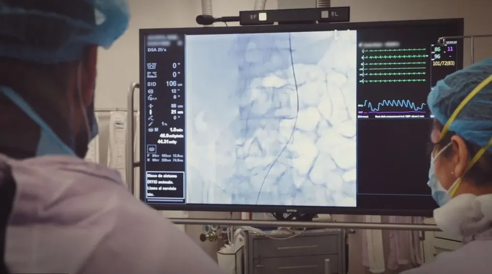 Angiógrafo del Hospital de Clínicas