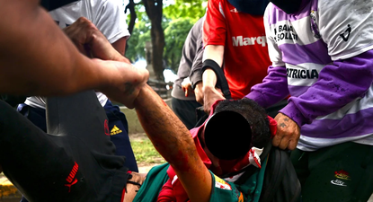 Pablo Grillo, el fotógrafo de 35 años herido en la marcha, fue operado en el Hospital Ramos Mejía y permanece en terapia intensiva, con pronóstico reservado.