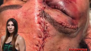 El impactante corte que sufrió una luchadora de MMA Irene Aldana