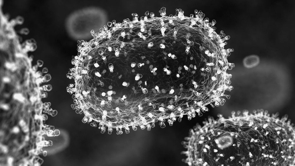 Así es el virus que causa la mpox visto en el microscopio.