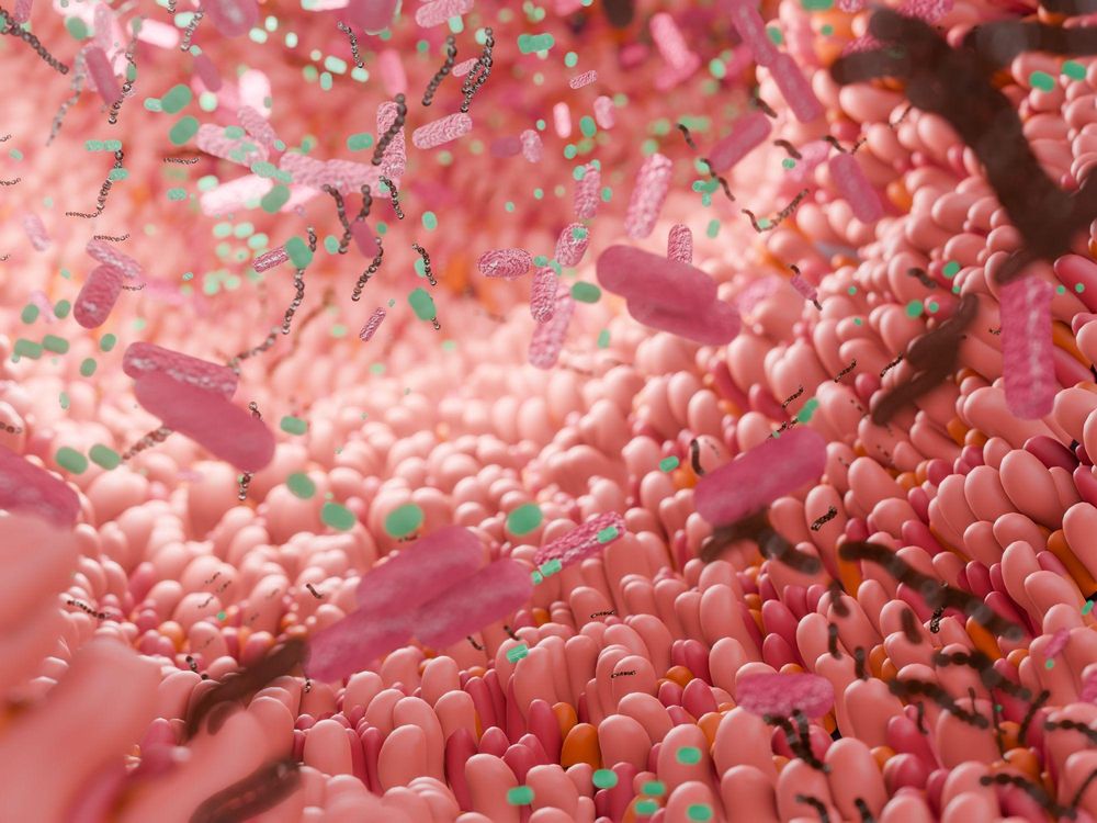 Los alimentos fermentados pueden contribuir a nuestro microbioma intestinal.