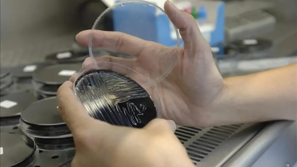 Análisis de una muestra tomada en unas torres de refrigeración