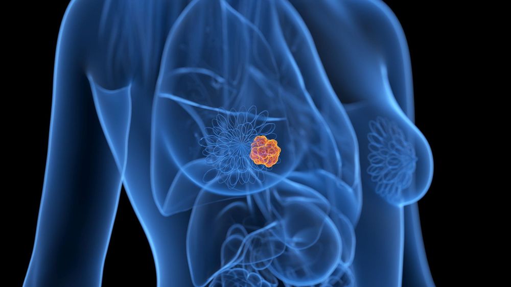 A Macarena le encontraron un tumor maligno en uno de sus senos.