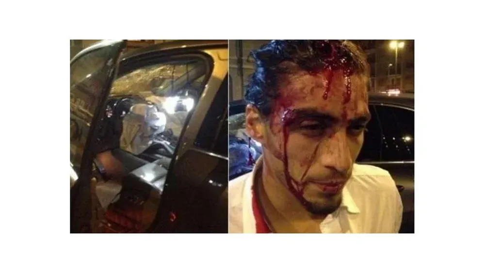 En su primer accidente terminó con un corte en la cabeza