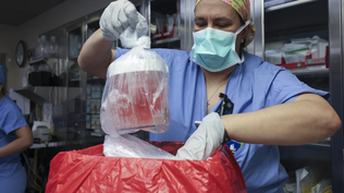 El primer trasplante de riñón de un cerdo modificado genéticamente