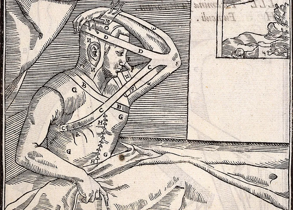 ¡20 días así, después de haber aguantado dos intervenciones anteriores sin anestesia!