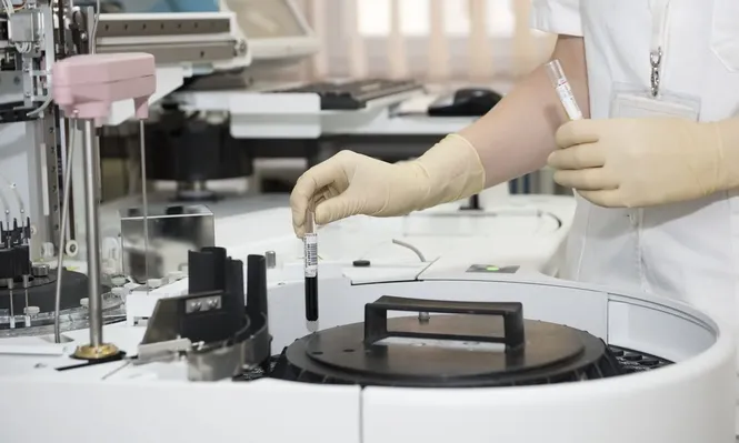 Análisis en laboratorios.