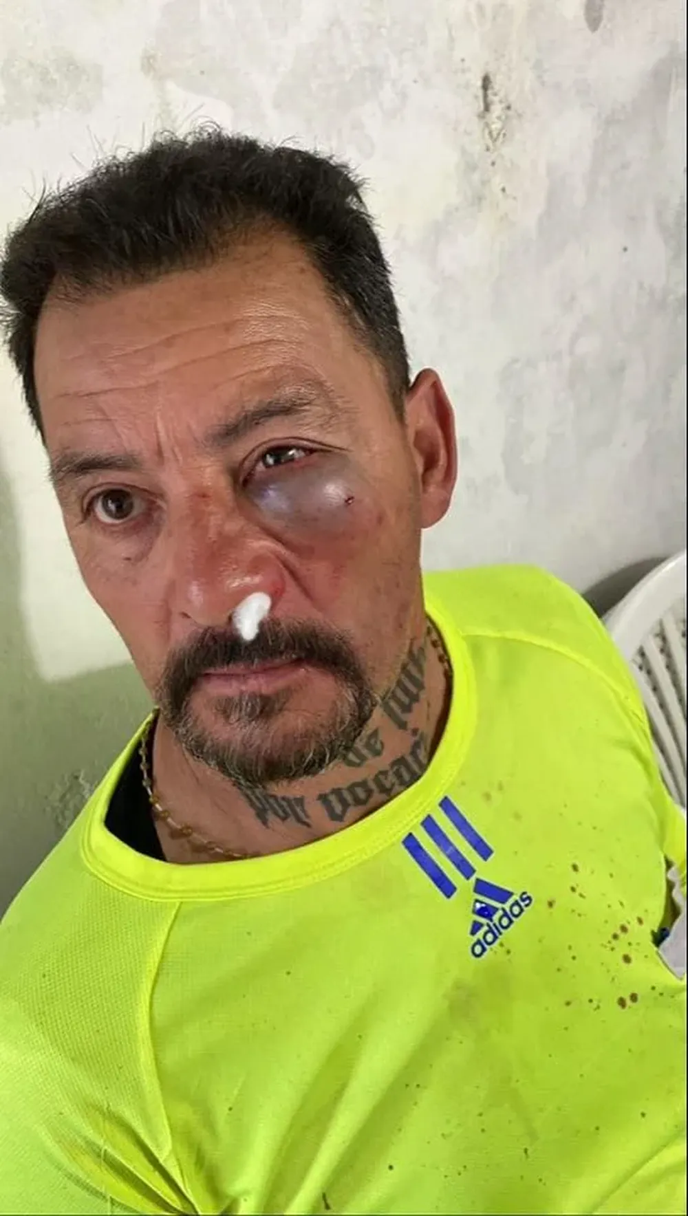 Agresión a Luis Fabregat