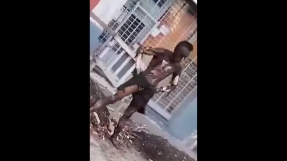 Un hombre terminó con el 90% del cuerpo quemado al intentar robar cables en Rosario