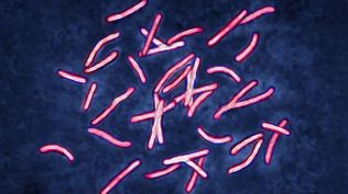 Los casos de tuberculosis (visto en la imagen) han aumentado en Reino Unido y en todo el mundo a medida que la enfermedad aumenta su resistencia a los antibióticos.