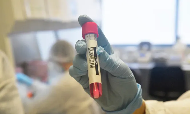 Rocha vuelve a tener casos activos de coronavirus