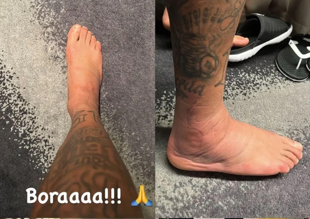 El tobillo de Neymar
