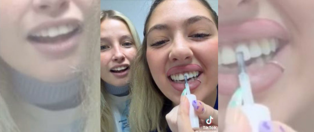 Peligro por el uso de esmalte de uñas para blanquearse los dientes.