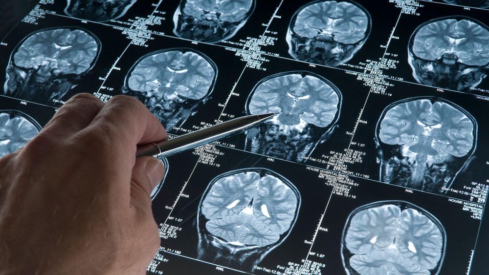 https://www.bbc.com/mundo/articles/c99718dpepro