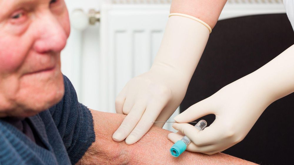 En EE.UU. se aprobó la primera prueba de sangre que la enfermedad de Alzheimer en sus primeras etapas.