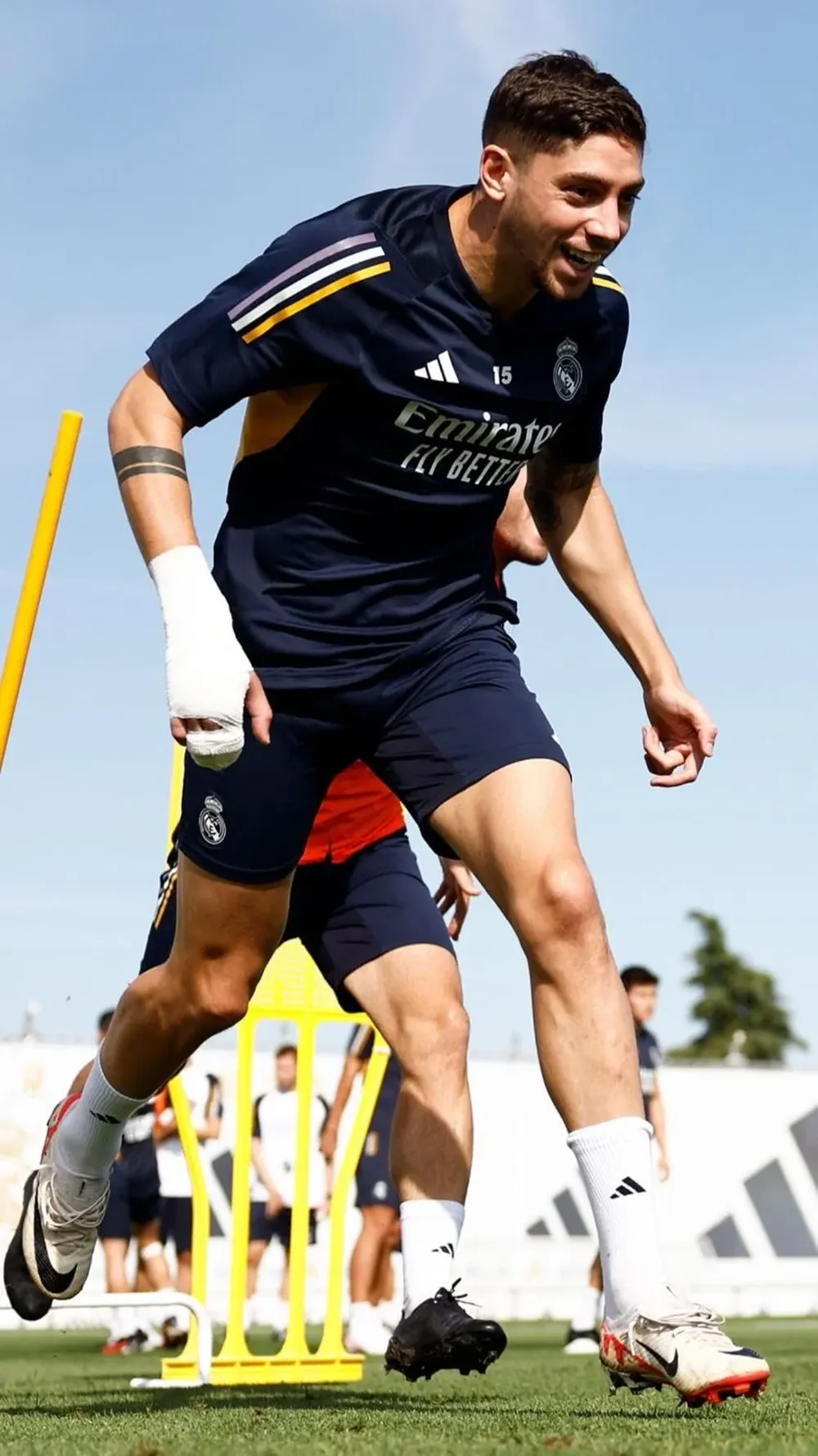 Las fotos de Federico Valverde con un vendaje en su mano