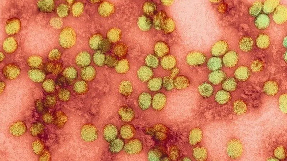 Entre los virus que transmite el nullAedes aegyptinull están el de zika, chikungunya y fiebre amarilla.