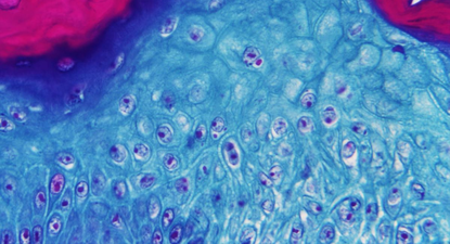 Virus de la mpox o viruela del mono en un microscopio