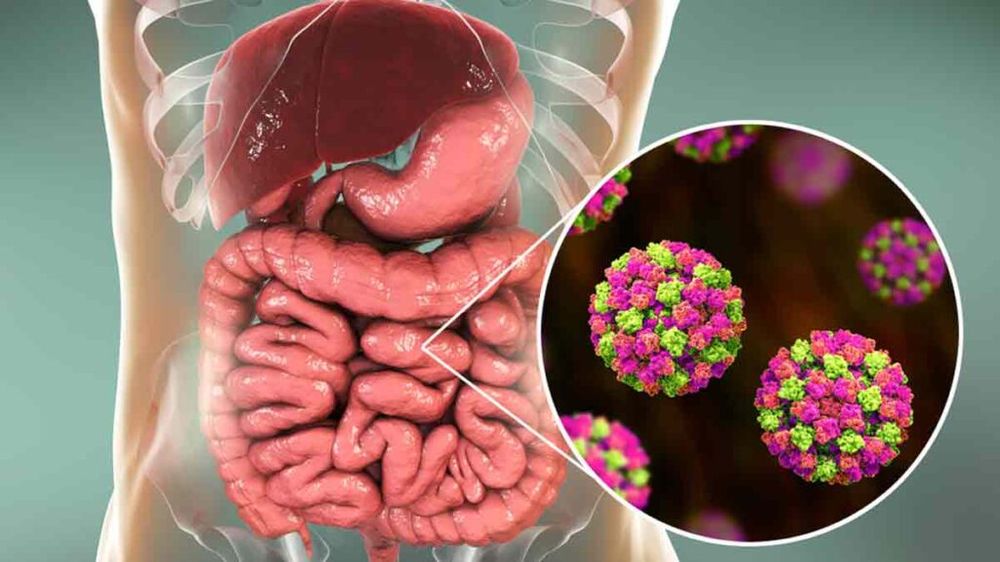 Norovirus en España, alerta por la suba de casos, síntomas y cómo protegerse.