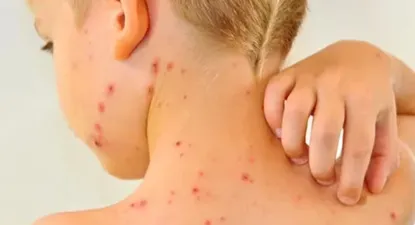 El Observador | 1707439680661.webp