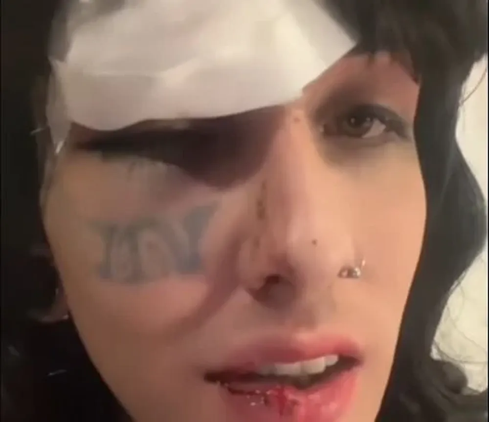 Así quedó Andrea Gianneo tras la golpiza que recibió este lunes