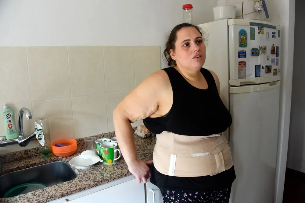 Ahora pesa 103 kilos y no puede bajar más.