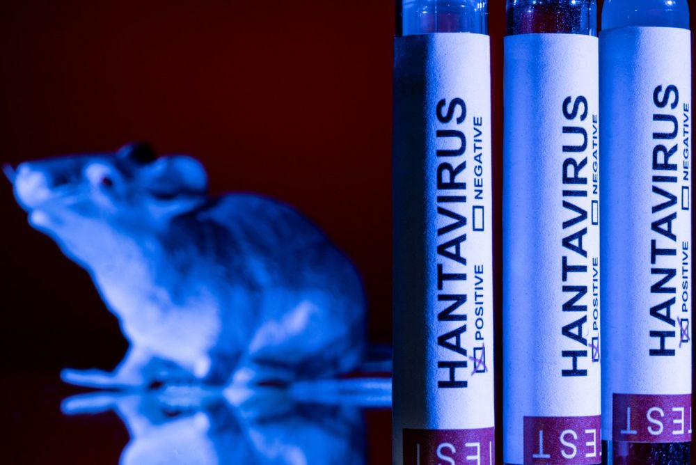 Hantavirus