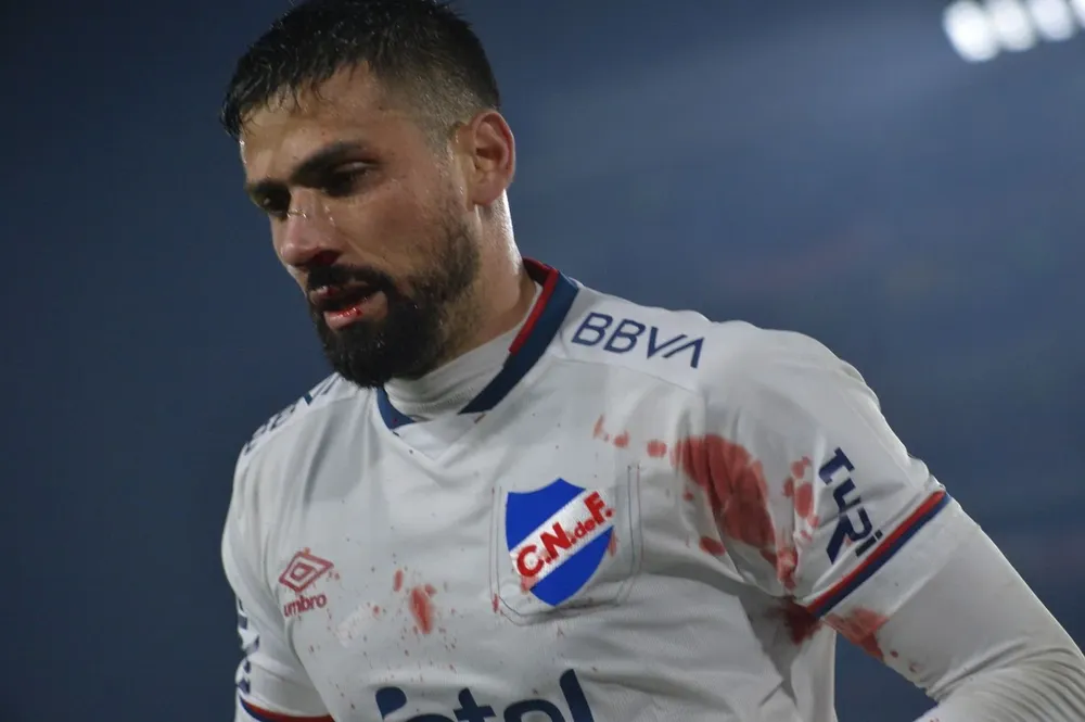 Mario Risso dejó la cancha en el segundo tiempo ante Rentistas